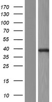 LIMS1 Human Over-expression Lysate