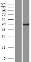 Caspase 12 (CASP12) Human Over-expression Lysate