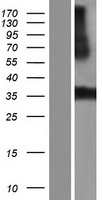 LRRC38 Human Over-expression Lysate