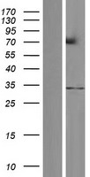 LOC285498 (RNF212) Human Over-expression Lysate