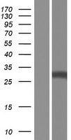 RBJ (DNAJC27) Human Over-expression Lysate