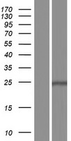 COQ7 Human Over-expression Lysate