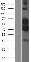 PCTAIRE1 (CDK16) Human Over-expression Lysate