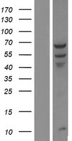 PPP2R1B Human Over-expression Lysate