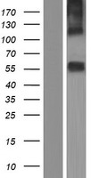 MCT7 (SLC16A6) Human Over-expression Lysate