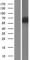 ZNF829 Human Over-expression Lysate