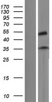 ZNF641 Human Over-expression Lysate