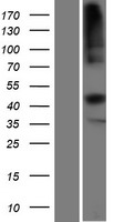 TCN2 Human Over-expression Lysate