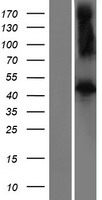 FBXL2 Human Over-expression Lysate