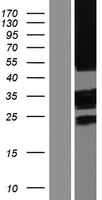 TMEM185A Human Over-expression Lysate