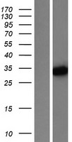 PGAM5 Human Over-expression Lysate