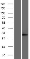 DCI (ECI1) Human Over-expression Lysate