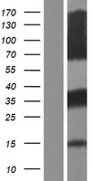 ACT (FHL5) Human Over-expression Lysate