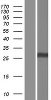 Endothelin 1 (EDN1) Human Over-expression Lysate