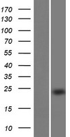 EFCAB9 Human Over-expression Lysate