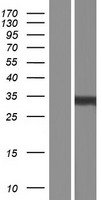 TSPAN3 Human Over-expression Lysate