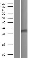 DMAC2 Human Over-expression Lysate
