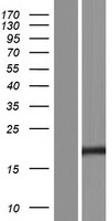 Caveolin 1 (CAV1) Human Over-expression Lysate