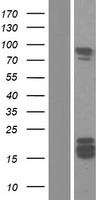 RTF1 Human Over-expression Lysate
