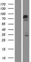 FAM161A Human Over-expression Lysate