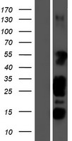 STK35 Human Over-expression Lysate