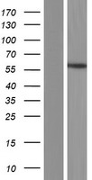 Estrogen Related Receptor beta (ESRRB) Human Over-expression Lysate
