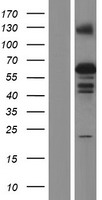 ZSCAN5B Human Over-expression Lysate