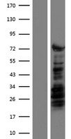 KLF4 Human Over-expression Lysate