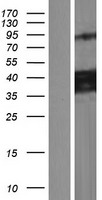 CCDC109B (MCUB) Human Over-expression Lysate