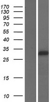 FOXI2 Human Over-expression Lysate