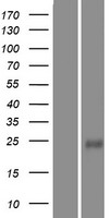LMO2 Human Over-expression Lysate