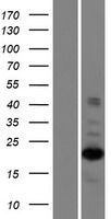 ZNF268 Human Over-expression Lysate