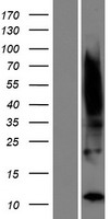 TIMM8B Human Over-expression Lysate