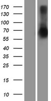 SETDB2 Human Over-expression Lysate