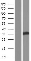 CDA11 (TATDN1) Human Over-expression Lysate