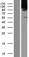 TIP120B (CAND2) Human Over-expression Lysate