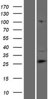 C7orf63 (CFAP69) Human Over-expression Lysate
