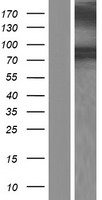 DBC2 (RHOBTB2) Human Over-expression Lysate