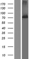 Slingshot homolog 1 (SSH1) Human Over-expression Lysate