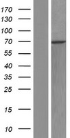 RBM28 Human Over-expression Lysate