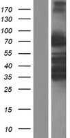 ARHGAP25 Human Over-expression Lysate