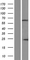 IQCC Human Over-expression Lysate