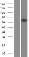 HNF1 beta (HNF1B) Human Over-expression Lysate