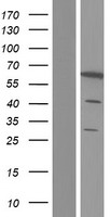 PDE1B Human Over-expression Lysate