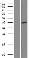 SAMD4A Human Over-expression Lysate
