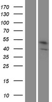 STEAP1B Human Over-expression Lysate