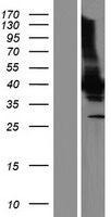MOV10L1 Human Over-expression Lysate