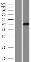 NEK6 Human Over-expression Lysate