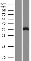 FHL1 Human Over-expression Lysate