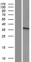 ZNF705G Human Over-expression Lysate